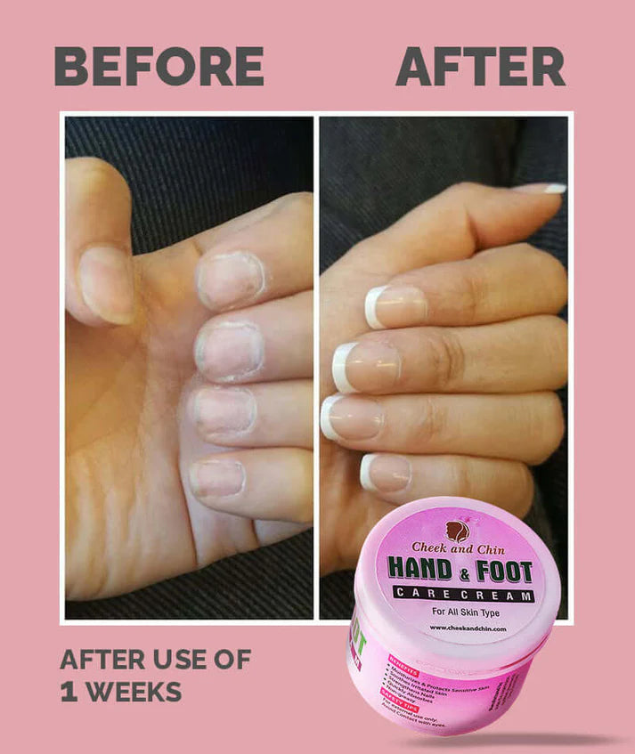 Cheek & Chin Hand & Foot Care Cream | 200g | Nourishing Formula | Effective Moisturizing & Everyday Skin Care